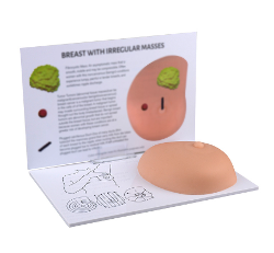 [SIM-BREAST-EXA] Simulador de mama con masas irregulares